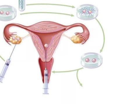 天津哪些医院可以做试管？做天津试管婴儿的流程有哪些？